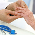 Raynauds and Arthritis