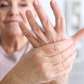White Fingers: Raynauds Symptoms