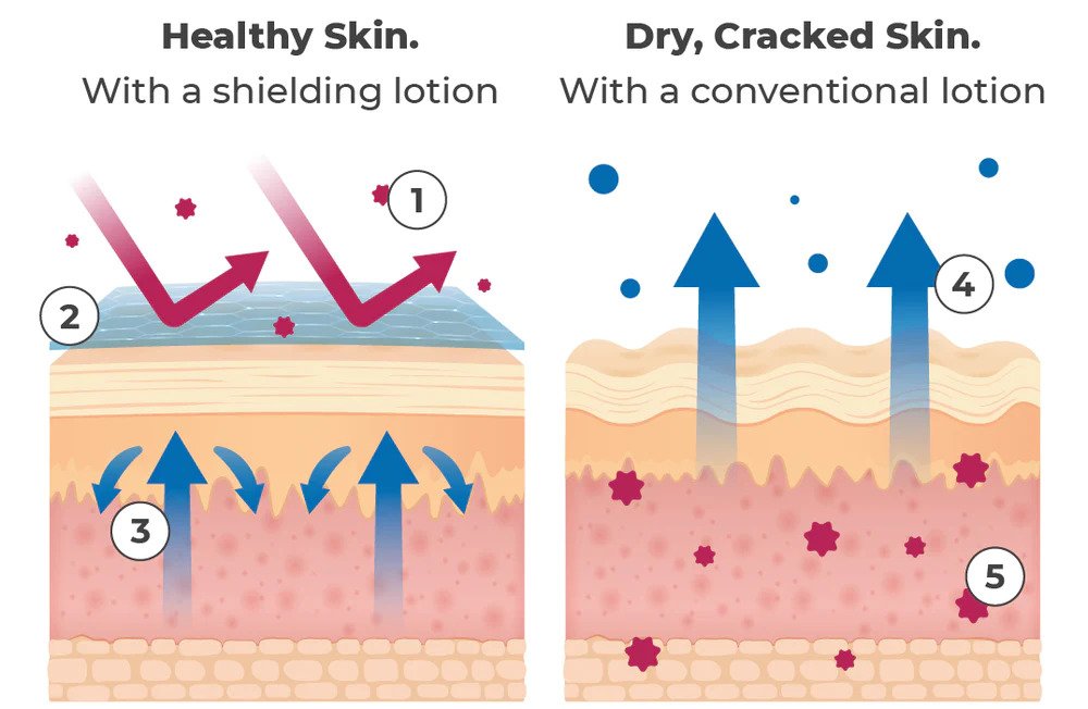 Diagram of skin with shielding lotion and without shielding lotion