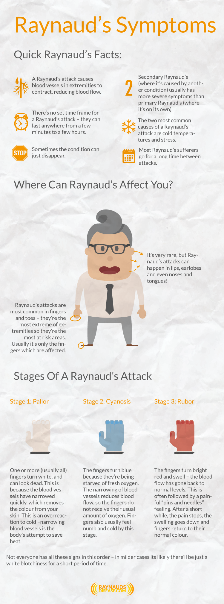 Learn More About the Symptoms of Raynaud's Disease